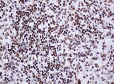 Immunohistochemistry: DCPS Antibody (OTI4H8) - Azide and BSA Free [NBP2-71839]