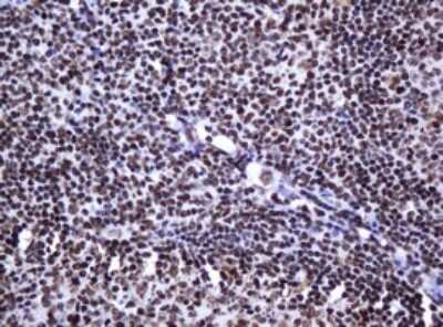 Immunohistochemistry: DCPS Antibody (OTI4H8) - Azide and BSA Free [NBP2-71839]