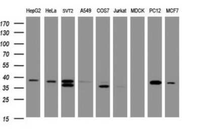 Western Blot: DCPS Antibody (OTI4H8)Azide and BSA Free [NBP2-71839]