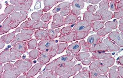 Immunohistochemistry-Paraffin: DCST1 Antibody [NBP1-59775]
