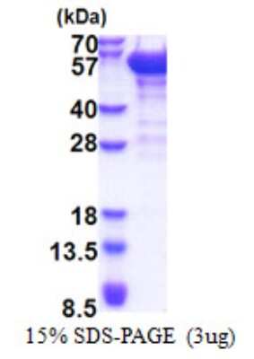 SDS-PAGE: Recombinant Human Dynactin Subunit 2/DCTN2/DCTN-50 His Protein [NBP2-23012]