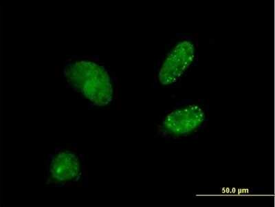 Immunocytochemistry/ Immunofluorescence: DCTN3 Antibody [H00011258-B01P]