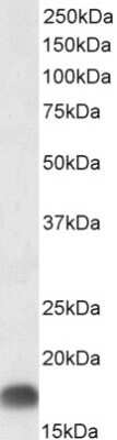 Western Blot: DCTN3 Antibody [NBP1-52105]