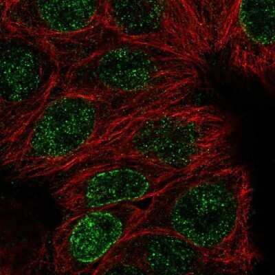 Immunocytochemistry/ Immunofluorescence: DCTN5 Antibody [NBP2-57058]