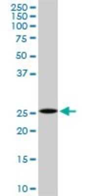Western Blot: DCUN1D1 Antibody (3D7) [H00054165-M01]