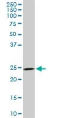 Western Blot: DCUN1D1 Antibody (4B5) [H00054165-M02]