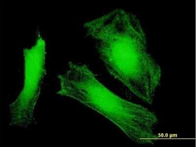 Immunocytochemistry/ Immunofluorescence: DCUN1D3 Antibody [H00123879-B01P]