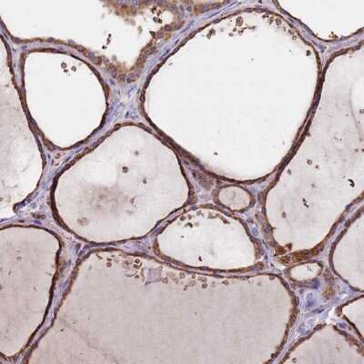 Immunohistochemistry-Paraffin: DCUN1D3 Antibody [NBP2-47494]