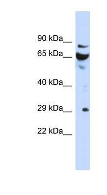 Western Blot: DCUN1D3 Antibody [NBP1-55387]