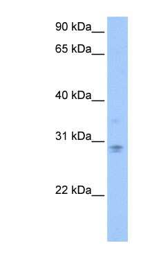Western Blot: DCUN1D3 Antibody [NBP1-55423]