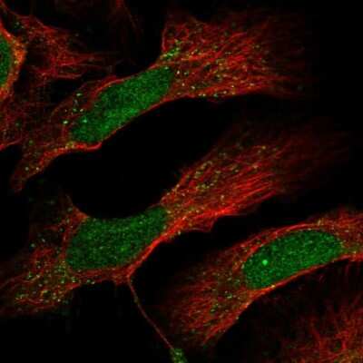 Immunocytochemistry/ Immunofluorescence: DCUN1D4 Antibody [NBP1-81526]