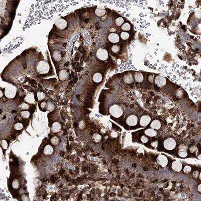 Immunohistochemistry-Paraffin: DCUN1D4 Antibody [NBP1-81527]