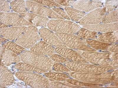 Immunohistochemistry-Paraffin: DCUN1D4 Antibody [NBP2-16119]