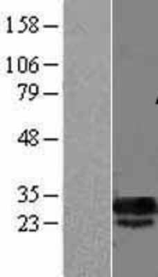 Western Blot: DCUN1D5 Overexpression Lysate [NBL1-09759]