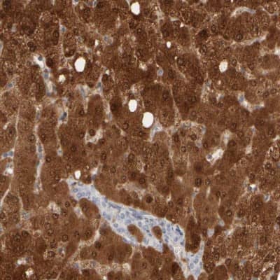 Immunohistochemistry-Paraffin: DCXR Antibody [NBP1-85280]