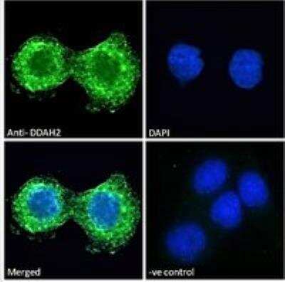Immunocytochemistry/ Immunofluorescence: DDAH2 Antibody [NB100-864]