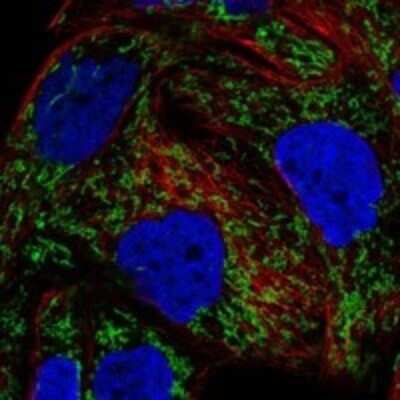 Immunocytochemistry/ Immunofluorescence: DDAH2 Antibody [NBP3-17699]
