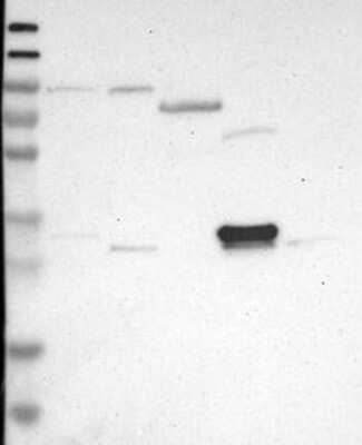 Western Blot: DDAH2 Antibody [NBP3-17699]