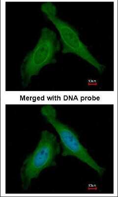 Immunocytochemistry/ Immunofluorescence: DDB1 Antibody [NBP1-33061]