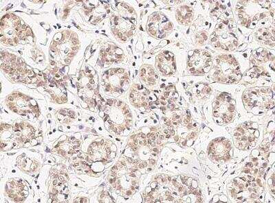 Immunohistochemistry-Paraffin: DDB1 Antibody [NBP2-98785]