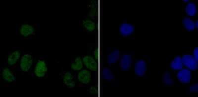 Immunocytochemistry/ Immunofluorescence: DDB1 Antibody (JU32-35) [NBP2-75465]