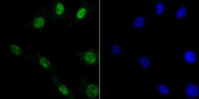 Immunocytochemistry/ Immunofluorescence: DDB1 Antibody (JU32-35) [NBP2-75465]