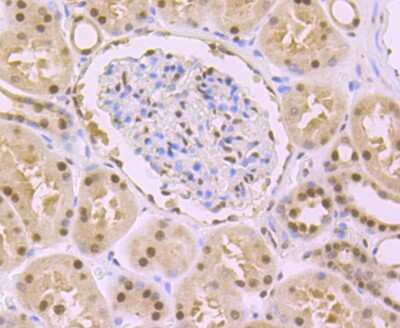 Immunohistochemistry-Paraffin: DDB1 Antibody (JU32-35) [NBP2-75465]