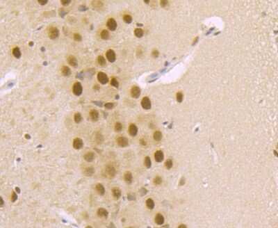 Immunohistochemistry-Paraffin: DDB1 Antibody (JU32-35) [NBP2-75465]