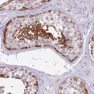 Immunohistochemistry-Paraffin: DDHD1 Antibody [NBP2-13903]
