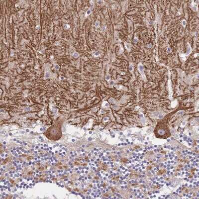 Immunohistochemistry-Paraffin: DDHD1 Antibody [NBP2-13903]