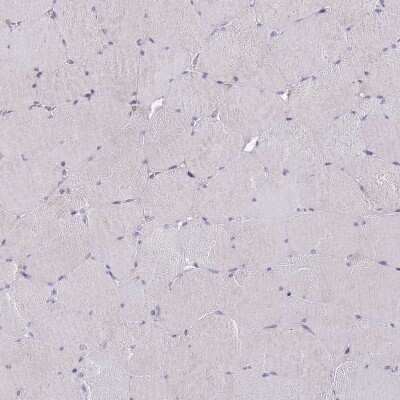 Immunohistochemistry-Paraffin: DDHD1 Antibody [NBP2-13903]