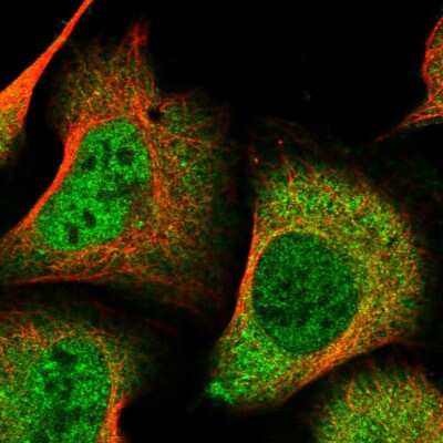 Immunocytochemistry/ Immunofluorescence: DDI2 Antibody [NBP2-47493]
