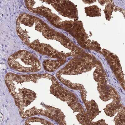 Immunohistochemistry: DDI2 Antibody [NBP2-47492]