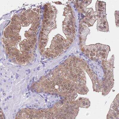 Immunohistochemistry-Paraffin: DDI2 Antibody [NBP2-47493]