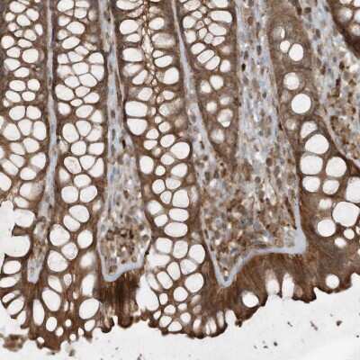 Immunohistochemistry-Paraffin: DDIT4 Antibody [NBP2-38208]