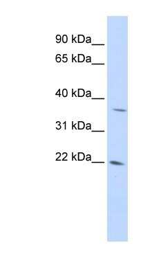 Western Blot: DDIT4L Antibody [NBP1-55005]