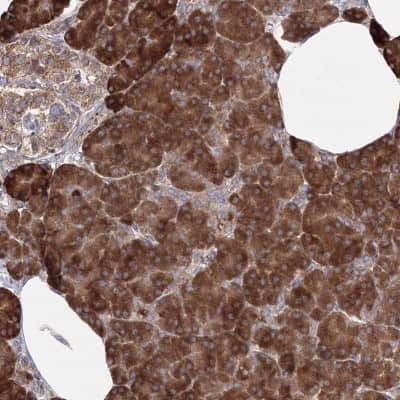 Immunohistochemistry-Paraffin: DDO Antibody [NBP2-32684]