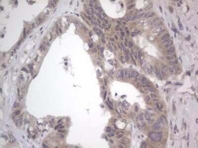 Immunohistochemistry: DDOST Antibody (OTI2B4) [NBP2-46439]