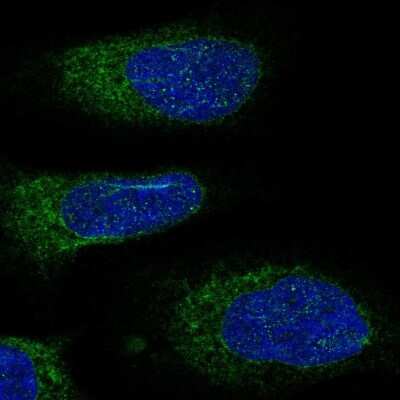 Immunocytochemistry/ Immunofluorescence: DDOST Antibody [NBP2-38560]