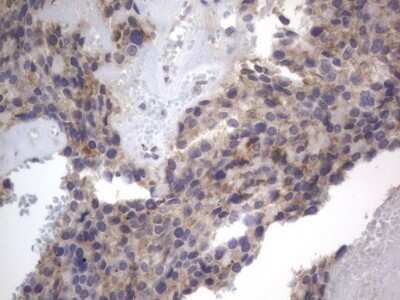 Immunohistochemistry: DDOST Antibody (OTI2B4) - Azide and BSA Free [NBP2-70561]