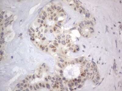 Immunohistochemistry: DDOST Antibody (OTI2B4) - Azide and BSA Free [NBP2-70561]