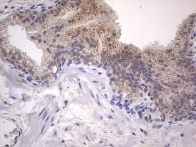 Immunohistochemistry: DDOST Antibody (OTI2B4) - Azide and BSA Free [NBP2-70561]