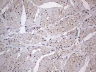 Immunohistochemistry: DDOST Antibody (OTI2B4) - Azide and BSA Free [NBP2-70561]