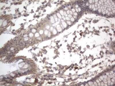 Immunohistochemistry: DDOST Antibody (OTI2B4) - Azide and BSA Free [NBP2-70561]