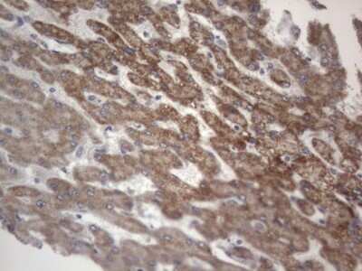 Immunohistochemistry: DDOST Antibody (OTI2B4) - Azide and BSA Free [NBP2-70561]