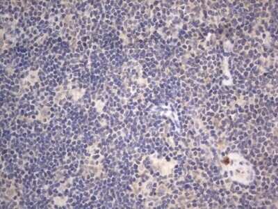 Immunohistochemistry: DDOST Antibody (OTI2B4) - Azide and BSA Free [NBP2-70561]