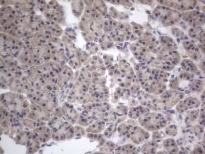 Immunohistochemistry: DDOST Antibody (OTI2B4) - Azide and BSA Free [NBP2-70561]