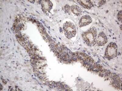 Immunohistochemistry: DDOST Antibody (OTI2B4) - Azide and BSA Free [NBP2-70561]