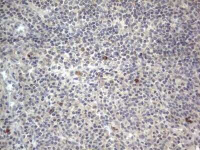 Immunohistochemistry: DDOST Antibody (OTI2B4) - Azide and BSA Free [NBP2-70561]