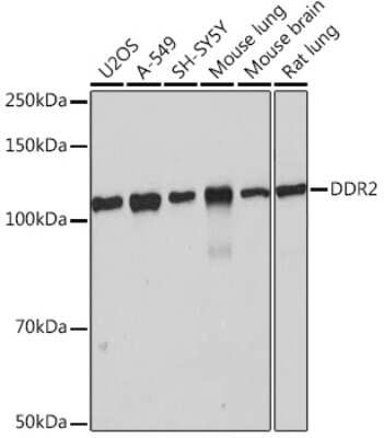 Western Blot: DDR2 Antibody (1M8U7) [NBP3-16371]